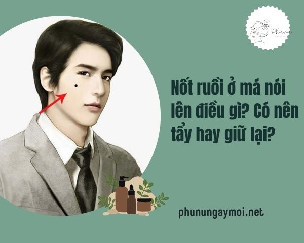 Nốt ruồi ở má