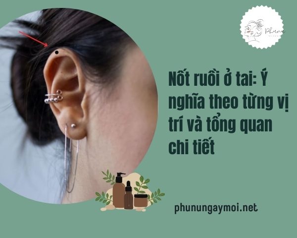 Nốt ruồi ở tai