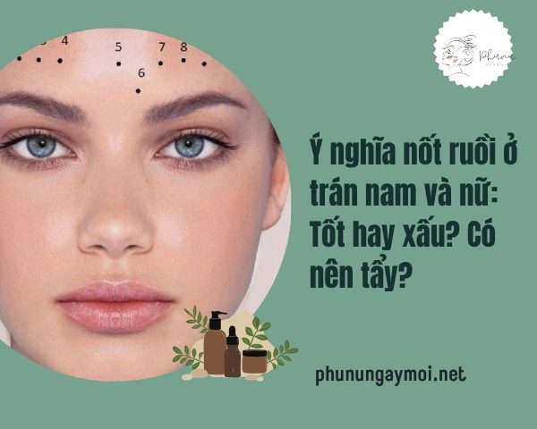 Nốt ruồi trên trán