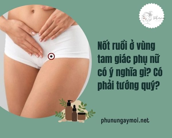 Nốt ruồi ở vùng tam giác