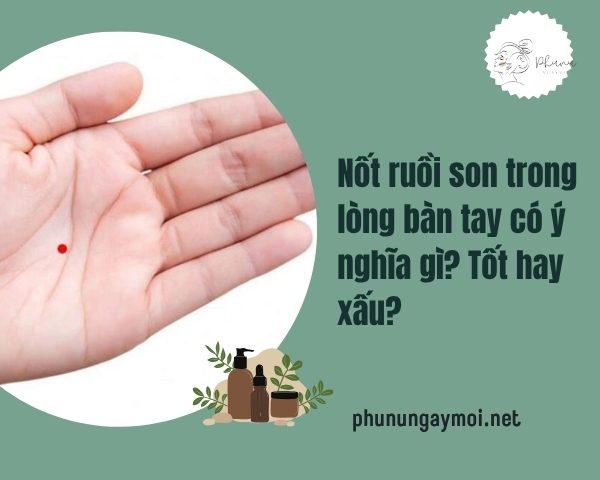 Nốt ruồi son trong lòng bàn tay