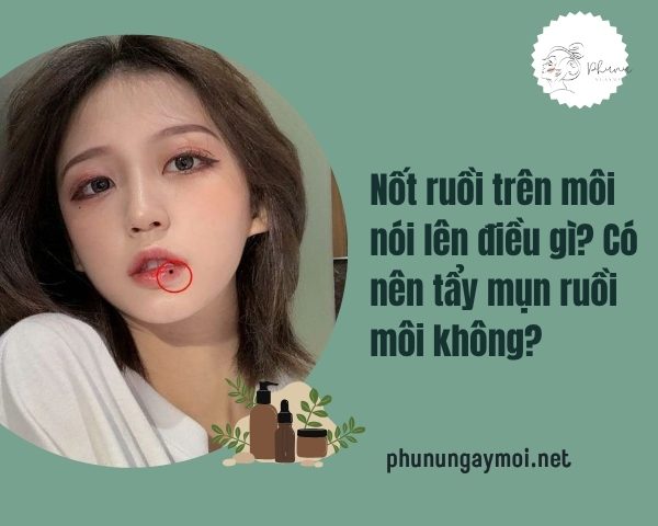 nốt ruồi trên môi