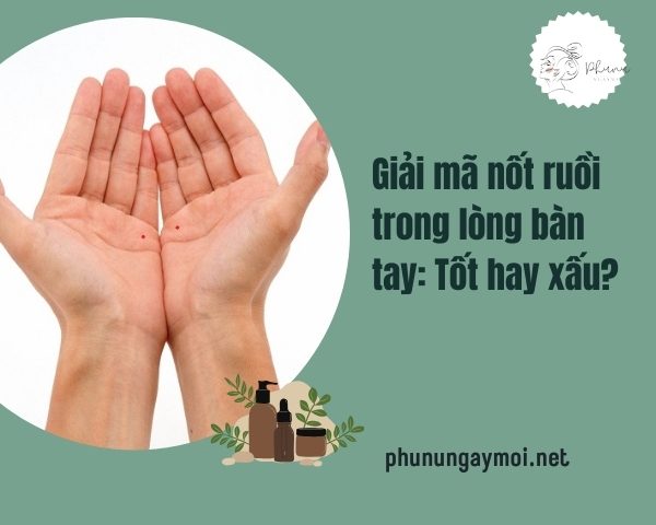 nốt ruồi trong lòng bàn tay