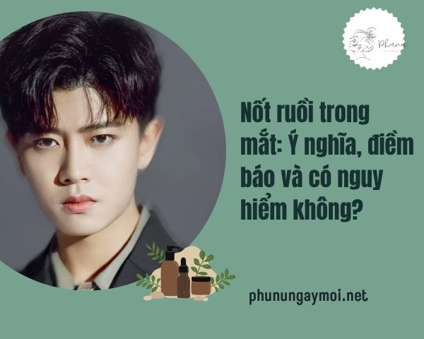 nốt ruồi trong mắt
