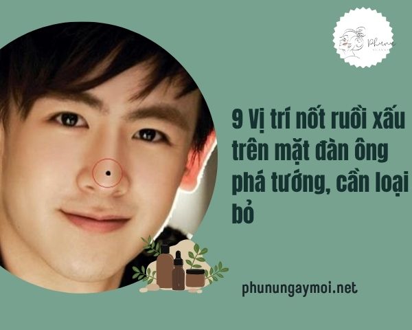 Nốt ruồi xấu trên mặt đàn ông