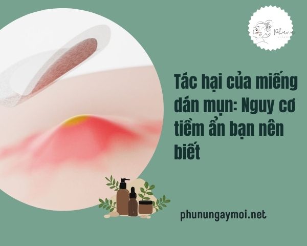 Tác hại của miếng dán mụn