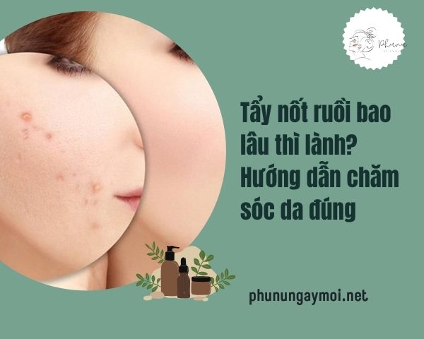 Tẩy nốt ruồi bao lâu thì lành