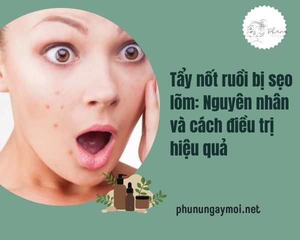 tẩy nốt ruồi bị sẹo lõm