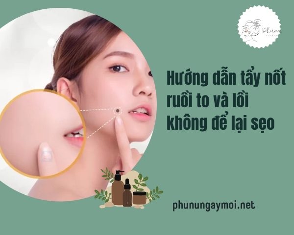 tẩy nốt ruồi to và lồi