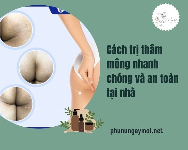 cách trị thâm mông