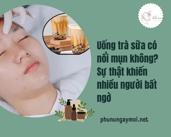 Uống trà sữa có nổi mụn không
