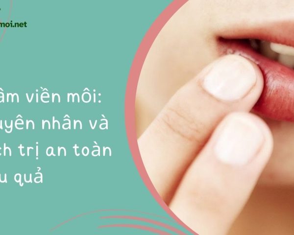 Thâm viền môi: Nguyên nhân và cách trị an toàn hiệu quả